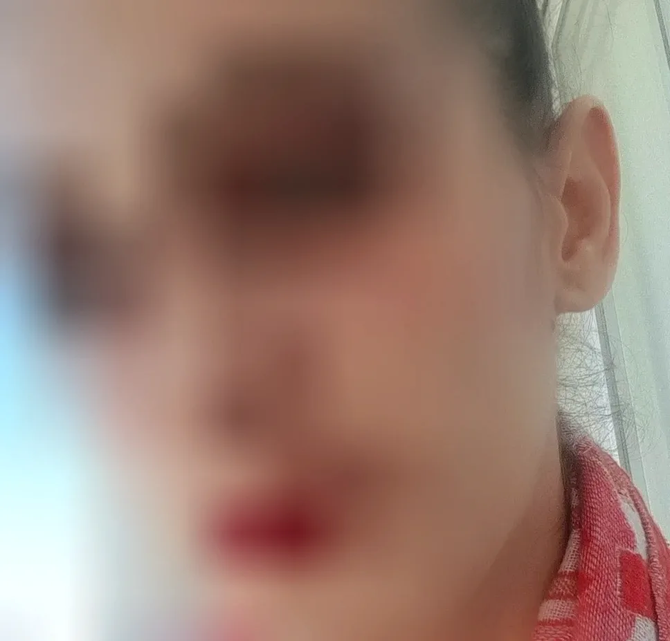 Iris, 37